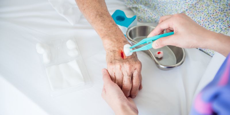 DISPOSITIVO PONTO FALSO: SUBSTITUTO IDEAL PARA AS SUTURAS TRADICIONAIS