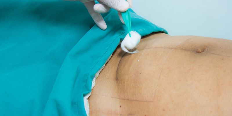 Curativo para fechar ferida